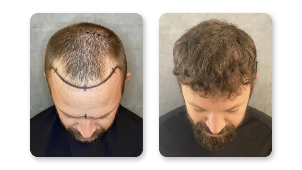 12 Months
