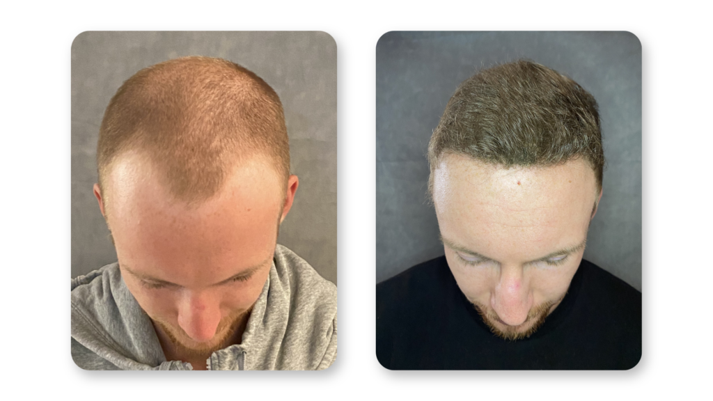 6 Months