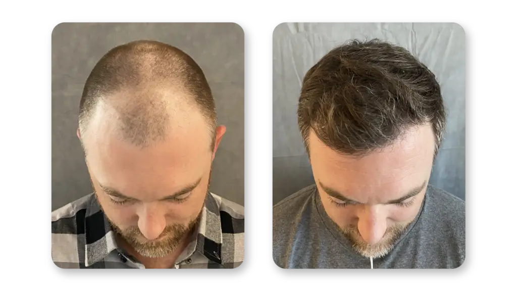6 Months