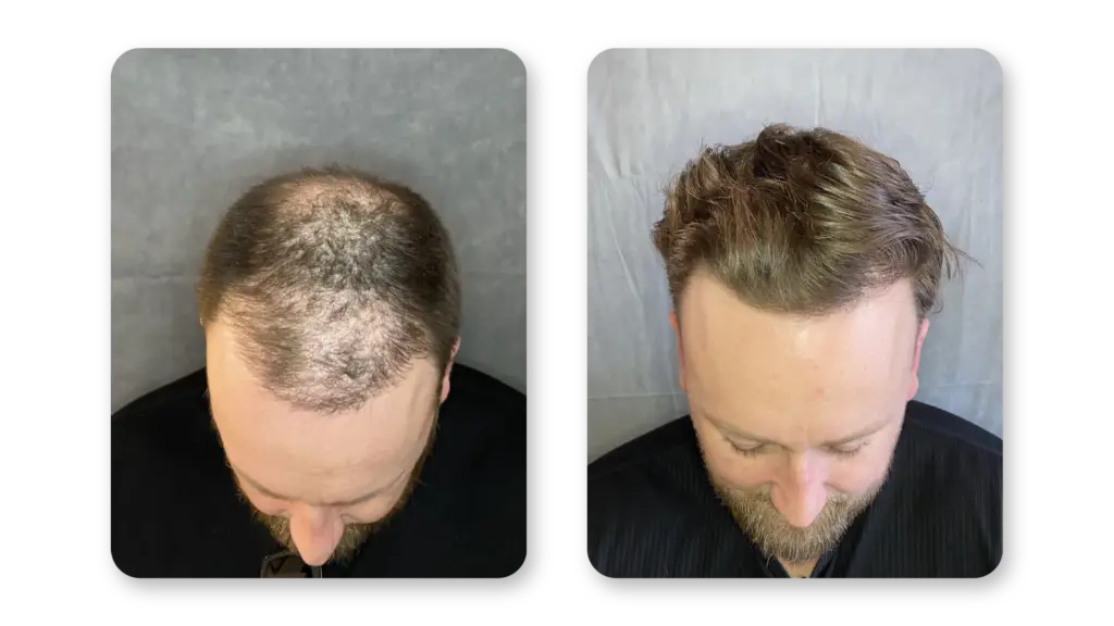 6 Months