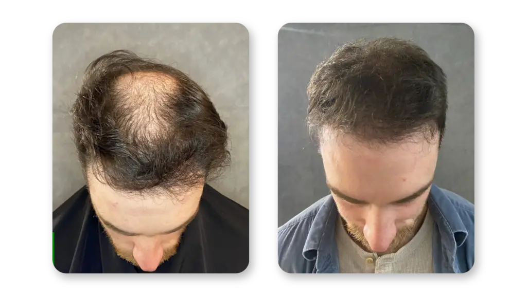 6 Months