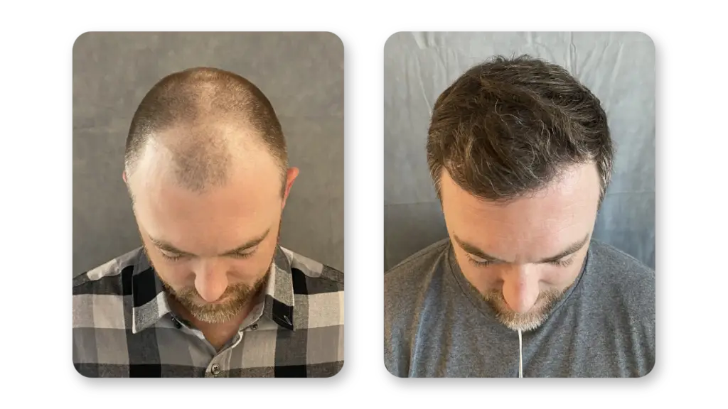6 Months