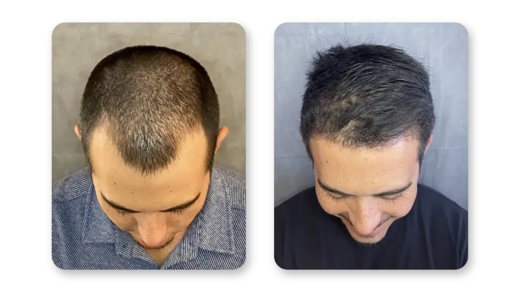 6 Months