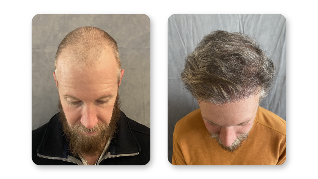 7 Months