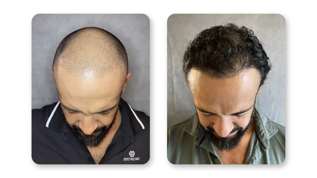 9 Months