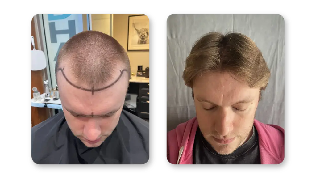9 Months