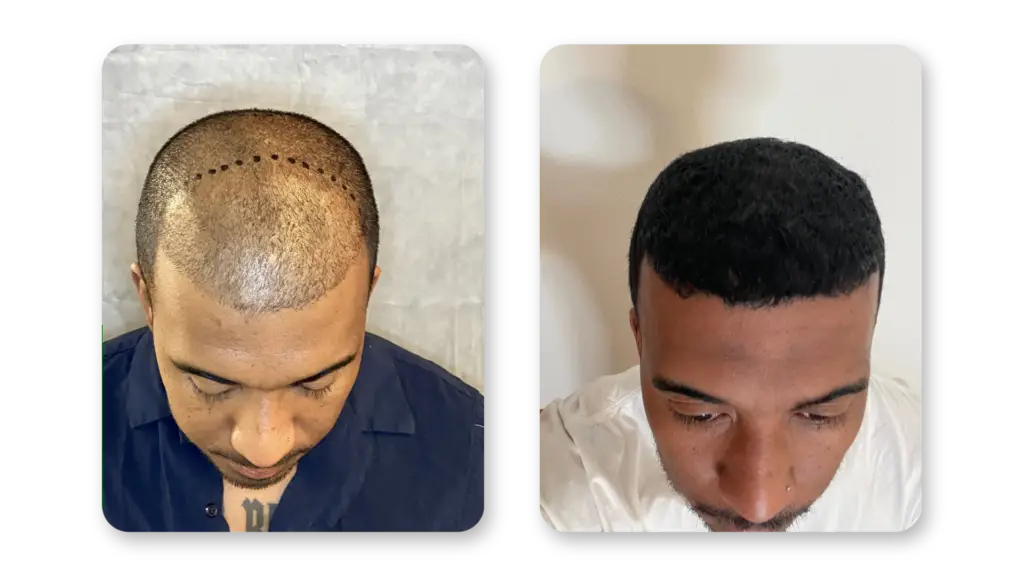 9 Months