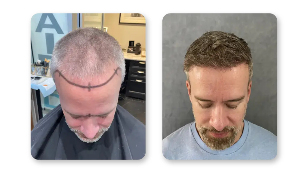 9 Months
